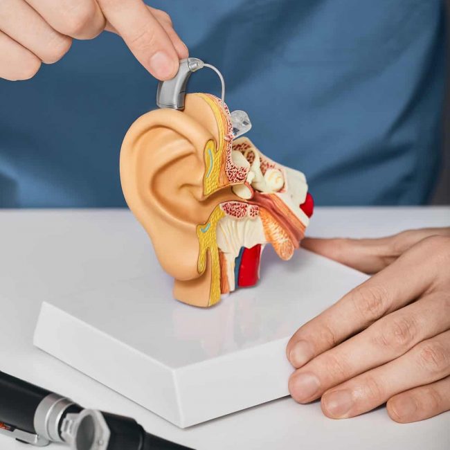 Doctor audiologist putting hearing aid on ear anatomical model. Treatment of deafness for hearing impaired with help of hearing aids